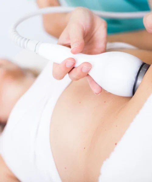 Cryoshaper Cryoshaper